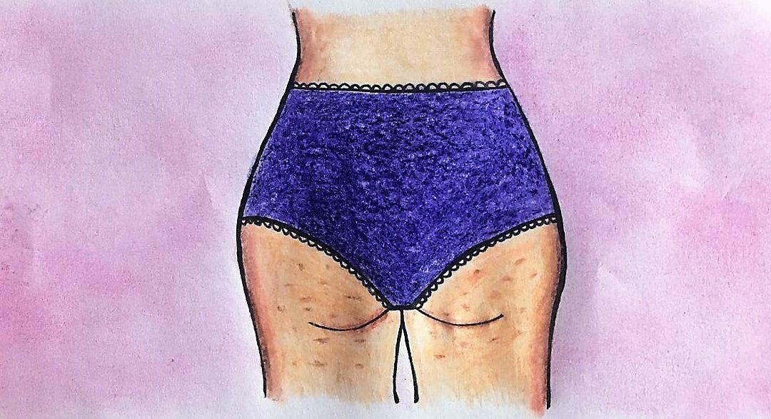 Tengo celulitis, ¡¿qué hago?!